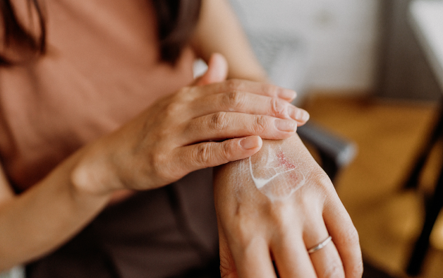 Soins pour l'eczéma et la dermatite de contact chez votre pharmacien en ligne